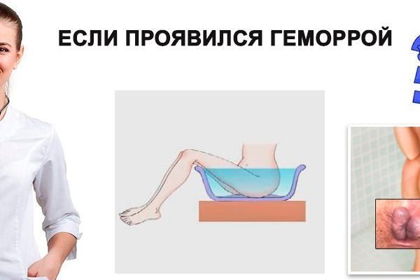 Кракен сайт vtor run